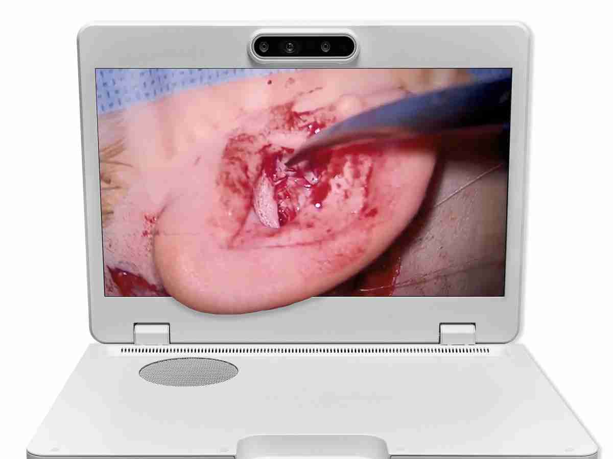 达擎之＂Heads-up 3D显微手术显示系统＂，，，，整合4K裸眼3D显示及眼球追踪系统，，，，具备快速追踪人眼移动位置功能，，，减轻医师长时间维持固定姿势的负担，，，让医师能有更宽广清晰的3D立体视野及更舒适的姿势来执行手术。。